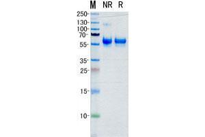 Validation with Western Blot (MMP1 Protein (Transcript Variant 1) (His tag))