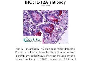 Image no. 1 for anti-Interleukin 12 alpha (IL12A) antibody (ABIN1735872) (IL12A antibody)