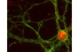 Indirect immunostaining of PFA fixed rat hippocampus neurons with anti-EPS 8 (dilution 1 : 500; red) and mouse anti-synaptotagmin 1 (, dilution 1 : 500; green).
