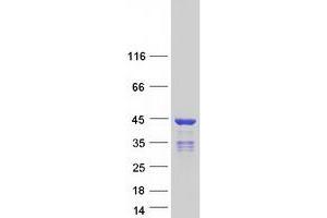 Validation with Western Blot (HNRNPC Protein (Transcript Variant 3) (Myc-DYKDDDDK Tag))