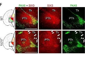 TCF7L2 controls the establishment of anatomical borders in the thalamus and habenula. (SIX3 antibody  (Internal Region))