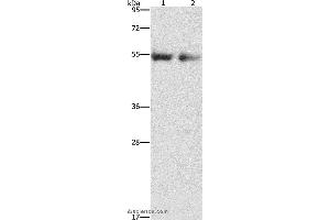 Western blot analysis of Human right lung and left lung cancer tissue, using ANGPT4 Polyclonal Antibody at dilution of 1:480 (Angiopoietin 4 antibody)