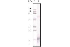 Western Blotting (WB) image for anti-Interferon gamma (IFNG) antibody (ABIN1107642) (Interferon gamma antibody)