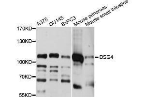 Western blot analysis of extracts of various cell lines, using DSG4 antibody.