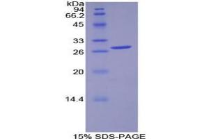 SDS-PAGE analysis of Human PDK1 Protein.