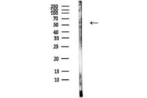Western blot analysis of lysates from EC304 cells(heat-shock, 45 min treatment), using Cytochrome P450 2R1 Antibody at 1/1000 dilution.