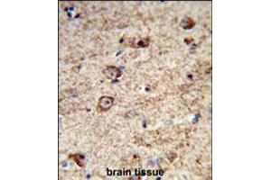 Formalin-fixed and paraffin-embedded human brain tissue reacted with LRRC4 Antibody , which was peroxidase-conjugated to the secondary antibody, followed by DAB staining. (LRRC4 antibody  (C-Term))
