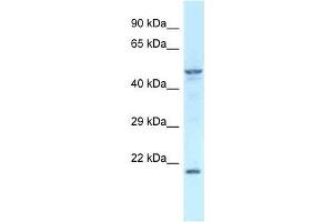 Western Blot showing Zfp113 antibody used at a concentration of 1. (Zfp113 antibody  (Middle Region))