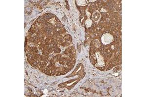 Immunohistochemical staining of human pancreas with DPYSL2 polyclonal antibody  shows cytoplasmic positivity in islet cells at 1:500-1:1000 dilution.