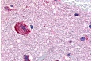 Human Brain, Caudate (formalin-fixed, paraffin-embedded) stained with GPR61 antibody ABIN213521 at 20 ug/ml followed by biotinylated goat anti-rabbit IgG secondary antibody ABIN481713, alkaline phosphatase-streptavidin and chromogen. (GPR61 antibody  (Cytoplasmic Domain))