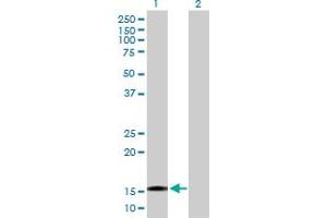 Western Blot analysis of TTC32 expression in transfected 293T cell line by TTC32 MaxPab polyclonal antibody. (TTC32 antibody  (AA 1-151))