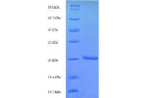 SDS-PAGE (SDS) image for Stimulator of Chondrogenesis 1 (SCRG1) (AA 21-98) protein (His-SUMO Tag) (ABIN4974535)