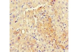 Immunohistochemistry of paraffin-embedded human liver tissue using ABIN7166014 at dilution of 1:100 (RMND5A antibody  (AA 1-391))