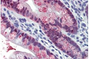 Small intestine, Human: Formalin-Fixed, Paraffin-Embedded (FFPE) (HOXC8 antibody  (AA 35-84))