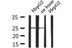 Western blot analysis of extracts from HepG2 and rat brain, using SOCS3 Antibody. (SOCS3 antibody  (C-Term))