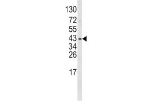 Western Blotting (WB) image for anti-Wingless-Type MMTV Integration Site Family, Member 5B (WNT5B) antibody (ABIN3003826) (WNT5B antibody)