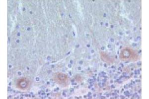 Rat brain zinc-fixed paraffin-embedded tissue (PKC delta antibody  (AA 114-289))