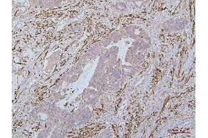 IHC analysis of Desmin using anti-Desmin antibody (ABIN7599249).