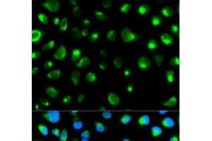 Immunofluorescence analysis of MCF-7 cells using GYPC Polyclonal Antibody (CD236/GYPC antibody)