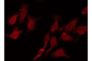 ABIN6275000 staining HepG2 by IF/ICC. (CNGA1 antibody  (Internal Region))