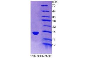 SDS-PAGE (SDS) image for Synuclein, gamma (Breast Cancer-Specific Protein 1) (SNCG) (AA 1-123) protein (His tag) (ABIN2126891)