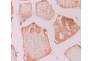 Used in DAB staining on fromalin fixed paraffin- embedded skeletal muscle tissue (IREB2 antibody  (AA 1-343))