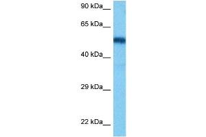 Host:  Rat  Target Name:  HNF1B  Sample Tissue:  Rat Liver  Antibody Dilution:  1ug/ml