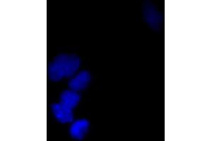 Immunofluorescence (IF) image for anti-Small Ubiquitin Related Modifier Protein 1 (SUMO1) (full length) antibody (FITC) (ABIN2452136) (SUMO1 antibody  (full length) (FITC))