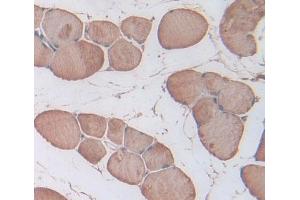 IHC-P analysis of skeletal muscle tissue, with DAB staining. (Triadin antibody  (AA 486-687))