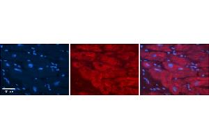 Rabbit Anti-PHB2 Antibody    Formalin Fixed Paraffin Embedded Tissue: Human Adult heart  Observed Staining: Cytoplasmic Primary Antibody Concentration: 1:600 Secondary Antibody: Donkey anti-Rabbit-Cy2/3 Secondary Antibody Concentration: 1:200 Magnification: 20X Exposure Time: 0.