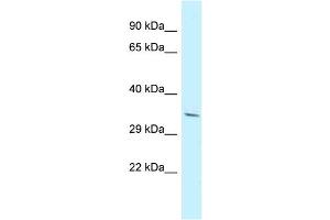 Host: Rabbit Target Name: PDLIM7 Sample Type: NCI-H226 Whole Cell lysates Antibody Dilution: 1.
