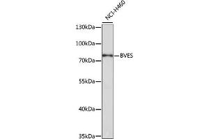 Western blot analysis of extracts of NCI-H460 cells, using BVES antibody (ABIN3020695, ABIN3020696, ABIN1512652 and ABIN6213674) at 1:1000 dilution.