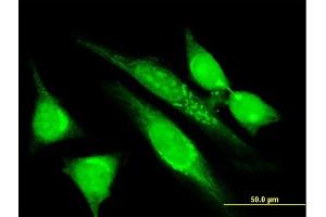 Immunofluorescence of monoclonal antibody to MGRN1 on HeLa cell. (Mahogunin RING Finger Protein 1 antibody  (AA 477-576))
