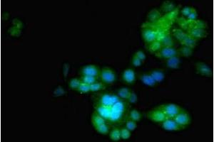 Immunofluorescent analysis of PC-3 cells using ABIN7151444 at dilution of 1:100 and Alexa Fluor 488-congugated AffiniPure Goat Anti-Rabbit IgG(H+L) (PHD1 antibody  (AA 283-407))