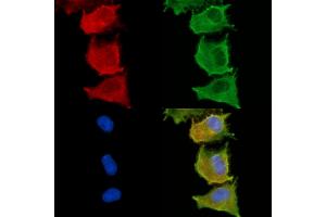 ABIN6263325 and ABIN6279013 staining  cells by IF/ICC.