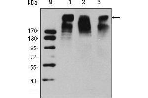 Western blot analysis using KI67 mouse mAb against Hela (1), MCF-7 (2) and Raji (3) cell lysate.