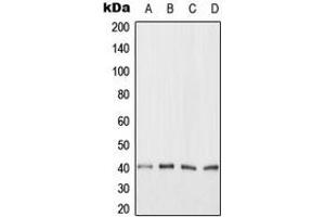 Western blot analysis of ANKRD1 expression in HeLa (A), Jurkat (B), NIH3T3 (C), H9C2 (D) whole cell lysates. (ANKRD1 antibody  (C-Term))