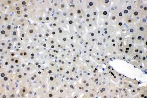 IHC analysis of NFIA using anti- NFIA antibody . (NFIA antibody  (Middle Region))