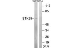 Western blot analysis of extracts from COLO cells, using STK39 (Ab-325) Antibody. (STK39 antibody  (AA 291-340))
