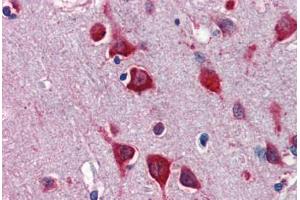 Human Brain, Cortex (formalin-fixed, paraffin-embedded) stained with TBX5 antibody ABIN462189 followed by biotinylated goat anti-rabbit IgG secondary antibody ABIN481713, alkaline phosphatase-streptavidin and chromogen. (T-Box 5 antibody  (AA 174-223))