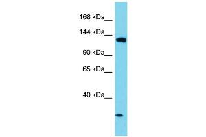 Host: Rabbit Target Name: EFTUD1 Sample Type: HepG2 Whole Cell lysates Antibody Dilution: 1. (EFTUD1 antibody  (C-Term))