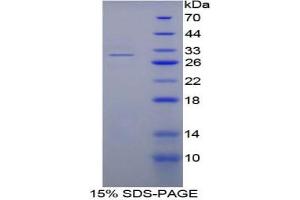 SDS-PAGE analysis of Mouse Fibrinogen alpha Protein.