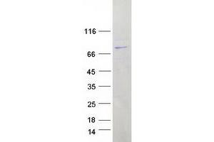 Validation with Western Blot