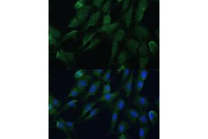 Immunofluorescence analysis of C6 cells using DRG2 antibody (ABIN7266746) at dilution of 1:100. (DRG2 antibody  (AA 150-260))