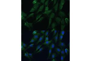Immunofluorescence analysis of C6 cells using DRG2 antibody (ABIN7266746) at dilution of 1:100.