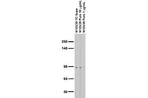 Adult rat brain membrane (RBM) immunoblot. (ALDH1L1 antibody  (AA 1-902))