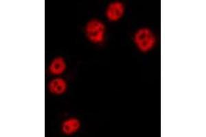 ABIN6275330 staining HepG2 by IF/ICC. (NOL10 antibody  (C-Term))