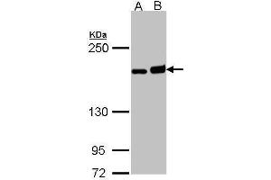 WB Image Sample (30 ug of whole cell lysate) A: H1299 B: Raji 5% SDS PAGE antibody diluted at 1:1000 (DIAPH1 antibody  (C-Term))