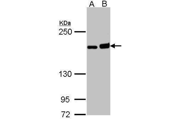 DIAPH1 antibody  (C-Term)