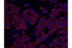 Immunofluorescence (IF) image for anti-Receptor tyrosine-protein kinase erbB-2 (ErbB2/Her2) (C-Term) antibody (ABIN7448962) (ErbB2/Her2 antibody  (C-Term))